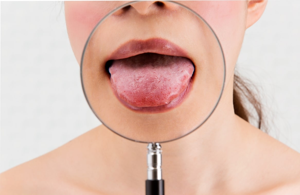 マイピラティス